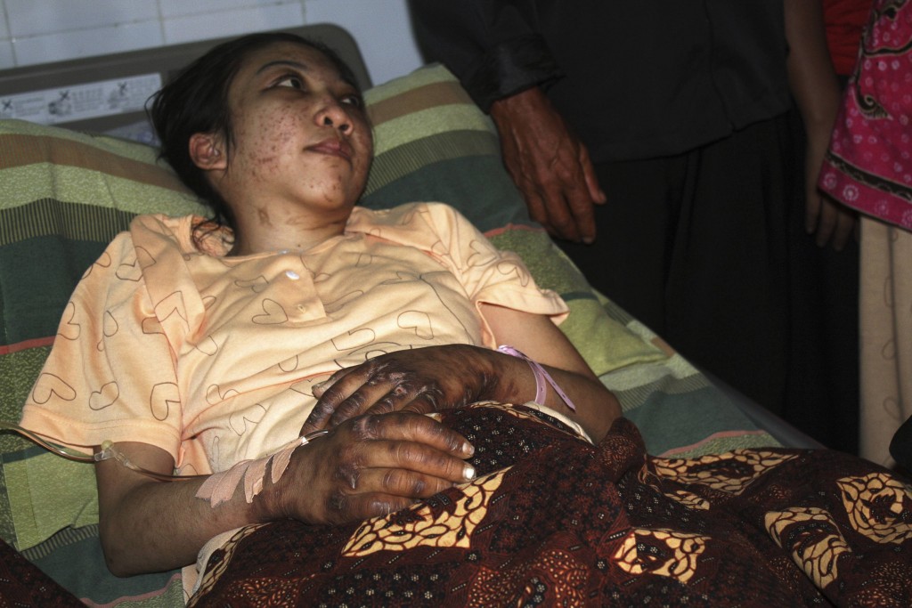 Indonesian domestic helper Erwiana Sulistyaningsih lies in a bed whilst being treated at a hospital in Sragen