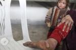 A woman with a foot showing symptoms of leishmaniasis waits to be treated at a hospital in Aleppo, February 11, 2013. Doctors in Aleppo and Deir al-Zor have reported outbreaks of leishmaniasis, an endemic tropical disease transmitted by sand-flies that causes skin ulcers resembling leprosy, the World Health Organization (WHO) said. Poor waste management and lack of hygiene have fuelled its spread, but the U.N. agency is trying to deliver medicines to both hotspots, WHO spokesman Glenn Thomas told a news briefing. REUTERS/Muzaffar Salman  (SYRIA - Tags: HEALTH CIVIL UNREST) - RTR3DN4X